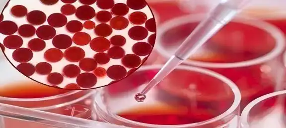 Integrating Astaxanthin into a Balanced Diet: Recipes and Tips